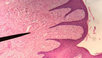 Consultorio De Patologia Y Medicina Bucal- Consultas- Dx Histopatológico - España