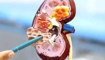 Dr. Martin Marie Tognola - Medicina interna y Nefrología en Toluca - Toluca De Lerdo