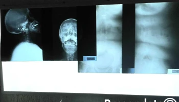 Mega Médica Dx. A.c. - Santa María