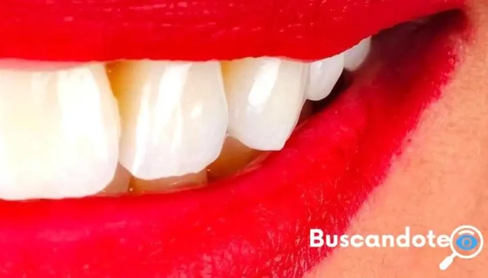Dentista Consultorio Dental - Chalma