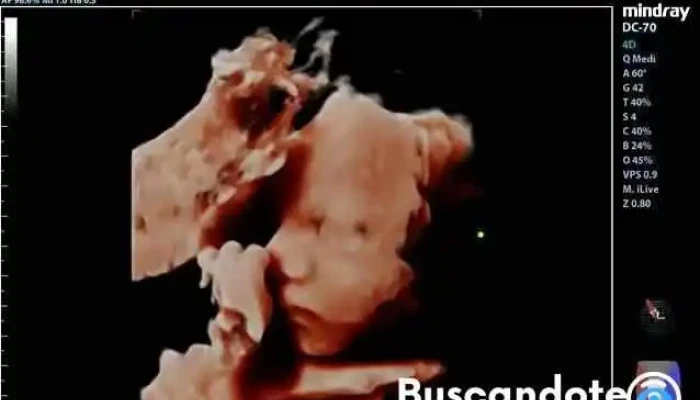 Dr Romeo Cid Contreras Ginecologia Y Obstetricia Videos - Santa Lucía del Camino